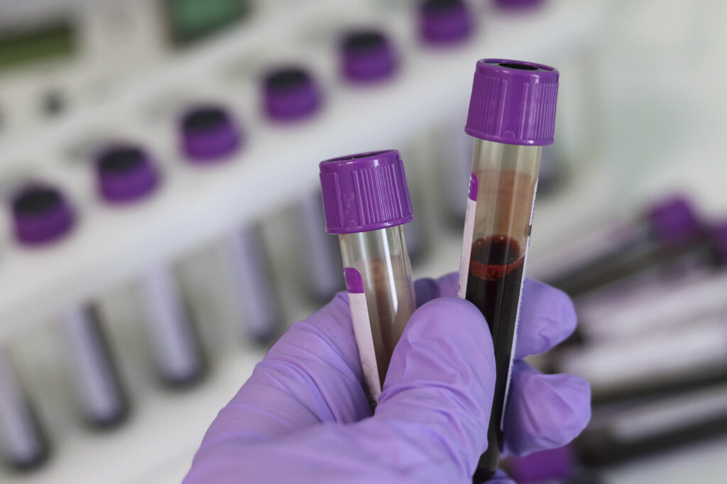 Biohazardous Waste blood vials